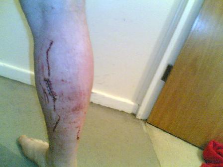 Wound 1.jpg